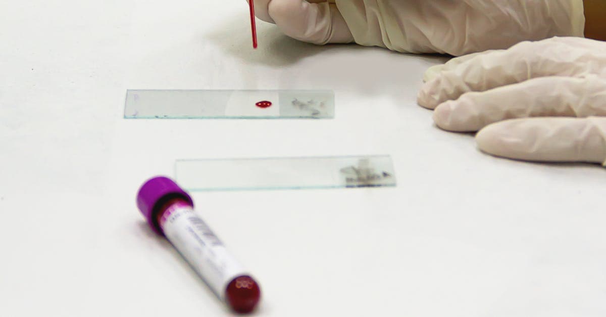 اهمیت آزمایش CBC و پارامترهای خونی