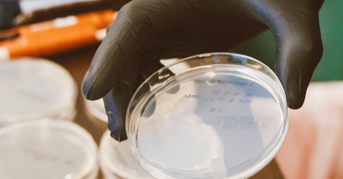 میکروب‌شناسی